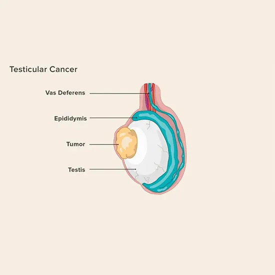 testicular cancer package test